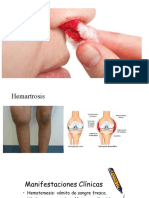 Leucemia - 7