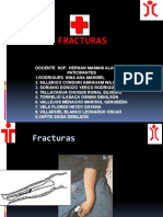 Diapositiva de Fracturas