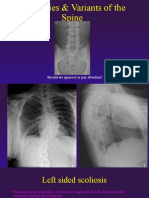 Anomalies Variants of The Spine