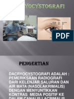 Dacryocystografi