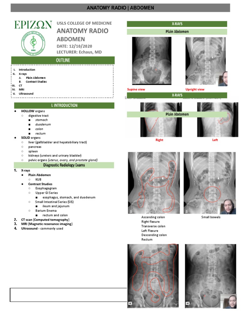 RADIO Abdomen | PDF | Abdomen | Large Intestine