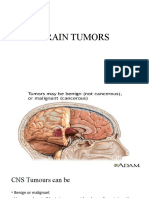 Brain Tumors