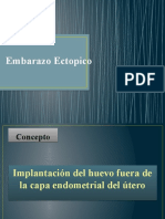 Embarazo Ectopico