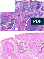 Oral Pathology II