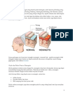 meningitis