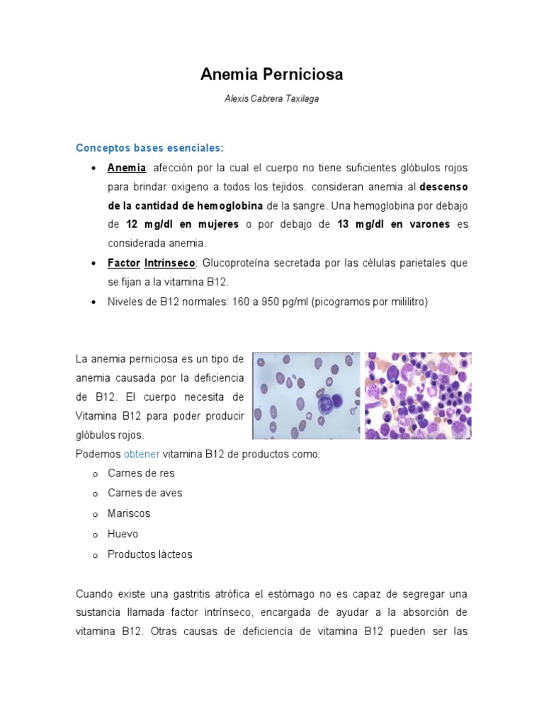 Anemia Perniciosa Cabrera Alexis PDF Vitamina B12 Anemia