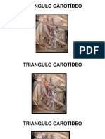 Triangulo Carotídeo