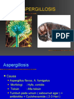 Aspergillosis 2