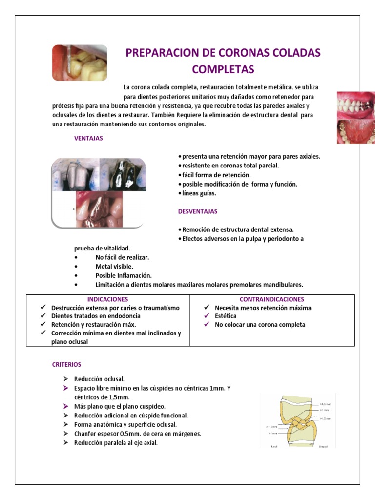 Preparación clínica para la realización de coronas coladas completas, PDF, Diente