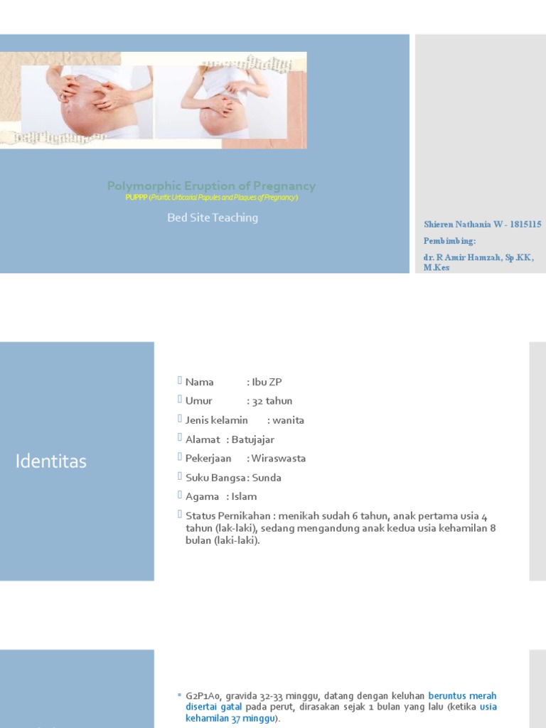 BST PUPPP (Pruritic Urticarial Papules and Plaques of Pregnancy