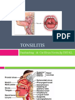 131003127-tonsilitis