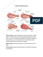 Etapas Del Trabajo de Parto