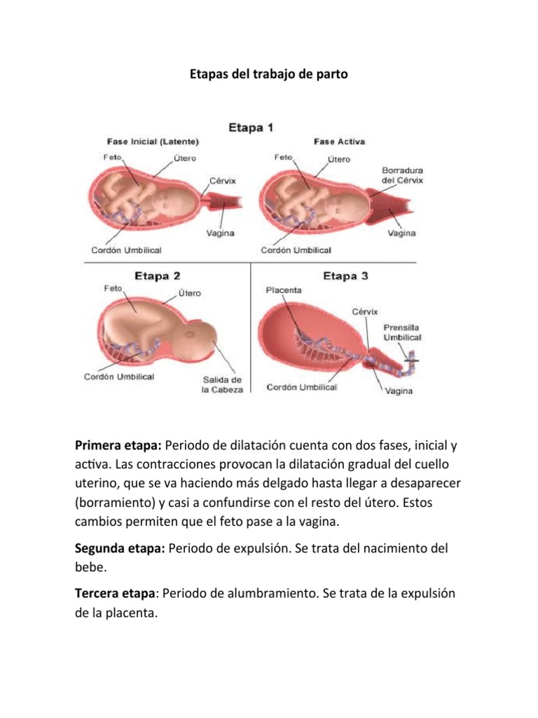 Etapas Del Trabajo de Parto | PDF | Salud y bienestar