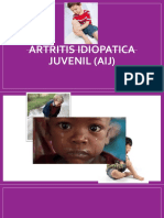 Artritis Ideopatica Juvenil - Diapos