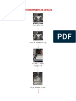 Determinación de Cenizas