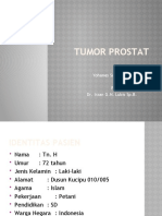 Tumor Prostat