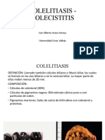 Colelitiasis y colecistitis