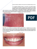 Variações anatômicas normais da boca