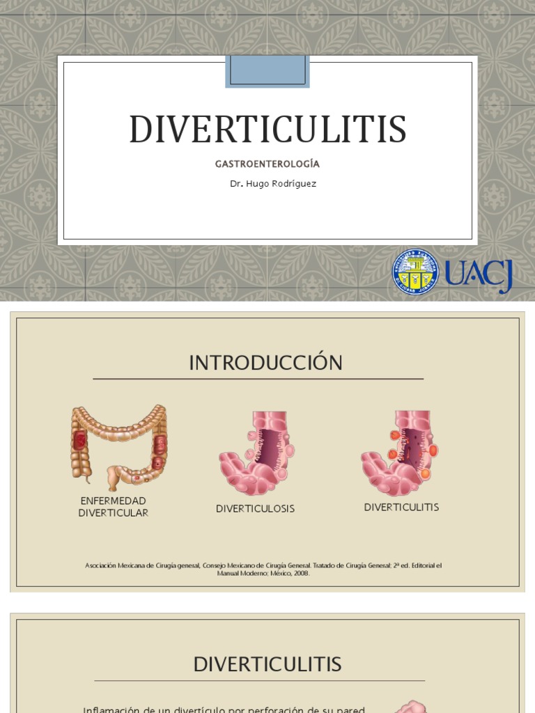 Diverticulitis 170312212001 | PDF | Especialidades Medicas ...