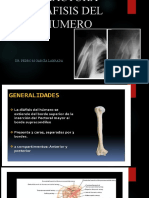 Fractura diáfisis humero