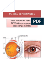 Askep Ablation Retina