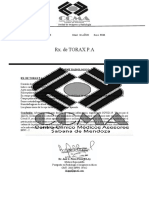 Rx. de Torax P.A: Informe Radiologico