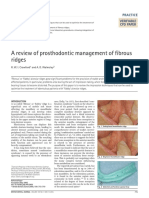 A Review of Prosthodontic Management of Fibrous Ridges: Practice