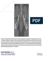 10 1148-Radiol 2018180492figure3