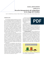 2007-Cap 46 Modificación Intraoperatoria Del Astigmatismo en La Cirugía Del Cristalino