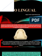 Arco Lingual