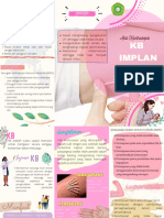 KB Implan: Cara Kerja