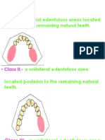 Class I:-: Bilateral Edentulous Areas Located Posterior To The Remaining Natural Teeth