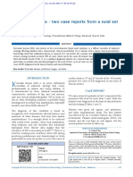 Kawasaki Disease Two Case Reports From A Rural Set Up in Gujarat