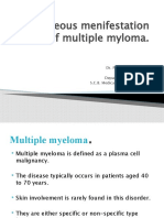 Cutaneous Menifestation of Multiple Myloma