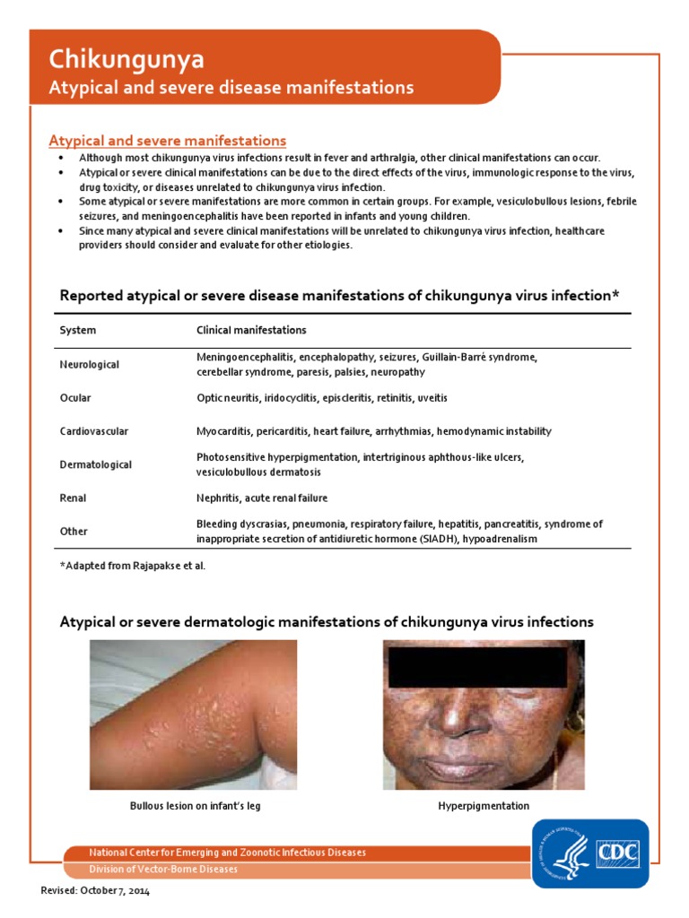 Chikungunya Fact Sheet , Chikungunya: Symptoms, Prevention and ...