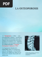 Clasificación de Genant en Fracturas Vertebrales | PDF | Osteoporosis ...
