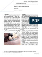 Archive of SID: Bluish Discoloration of Periodontal Tissue