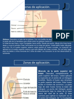 Zonas de Aplicacion.