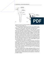 (A) Total Hip Replacement Prosthesis (B) Total Knee Replacement Prosthesis