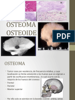 OSTEOMA OSTEOIDE