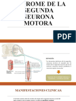 Síndrome de La Segunda Neurona Motora