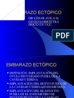 Embarazo Ectópico - Modificado