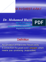 Empyema in Chest X-Ray: Dr. Mohamed Hussein Aden