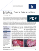 Oral Medicine - Update For The Dental Practitioner