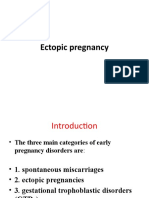 Ectopic Pregnancy