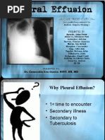 Pleural Effusion