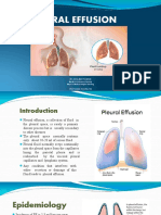 pleuraleffusion-160424141916