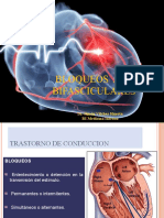 Bloqueos Av y Bifasciculares Simon