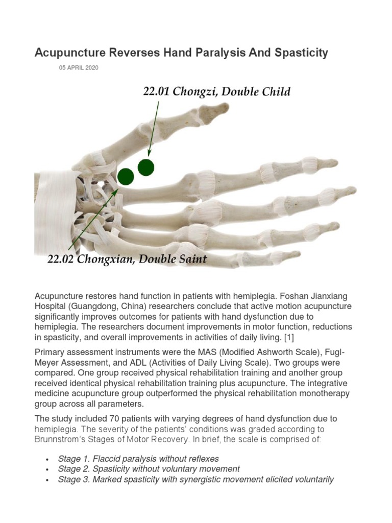 Acupuncture Reverses Hand Paralysis and Spasticity PDF Acupuncture