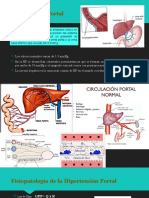 Hipertensión Portal